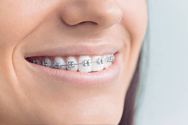 Best Veneers and Lumineers  in Jarrettsville, MD
